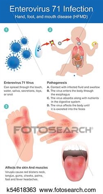 How to feed and water a child with enterovirus infection