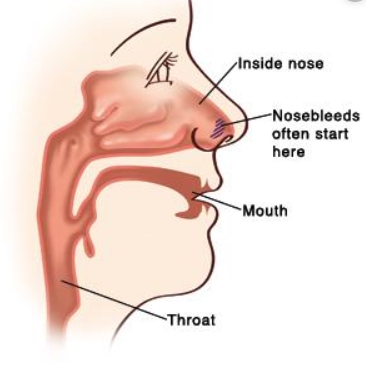 Saignement des gencives, du nez, des ecchymoses chez un enfant de 7 ans