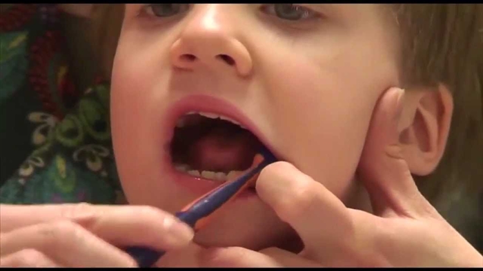 Lapsi pelkää hoitaa hampaita 5-vuotiaana