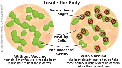 About the pneumococcal vaccine if the child has had pneumonia