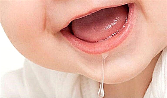 Simptomi nicanja zuba u dojenčadi