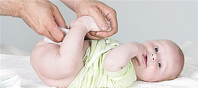 Cómo manejar los pliegues en un recién nacido