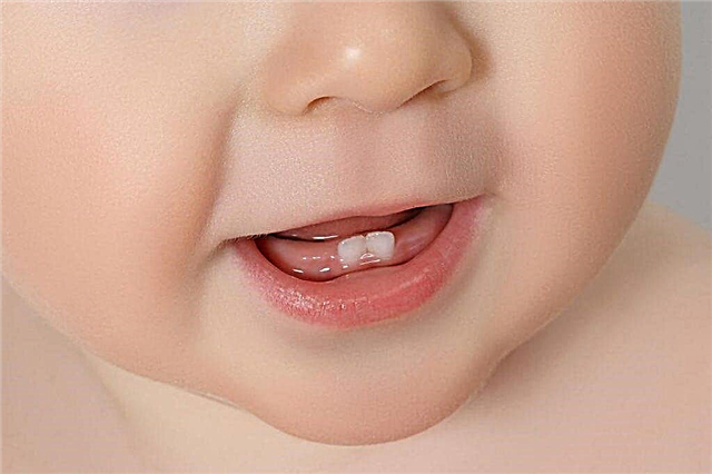 Første tenner hos babyer
