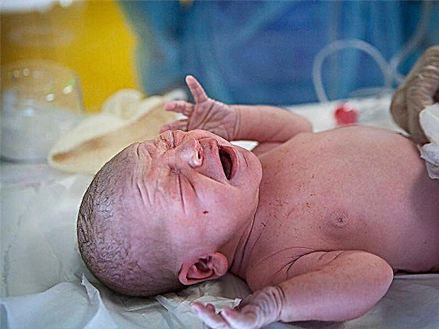 Meconio en recién nacidos: la descripción de las heces es normal, con desviaciones