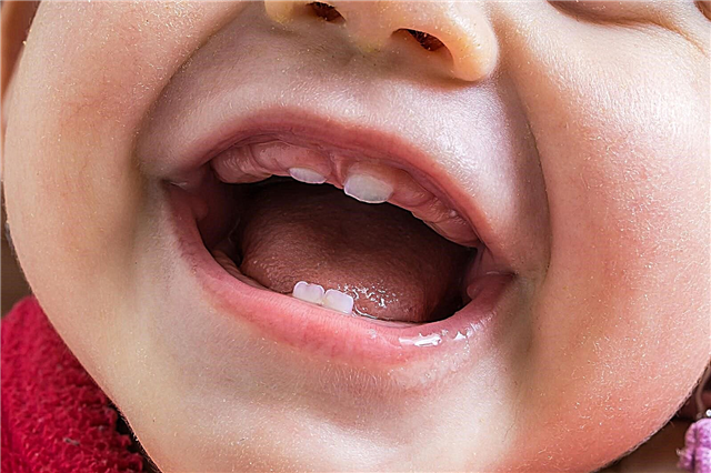 Cronograma de dentição para crianças menores de um ano