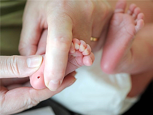 Pemeriksaan tumit pada bayi baru lahir - mengapa mereka dianalisis di hospital?