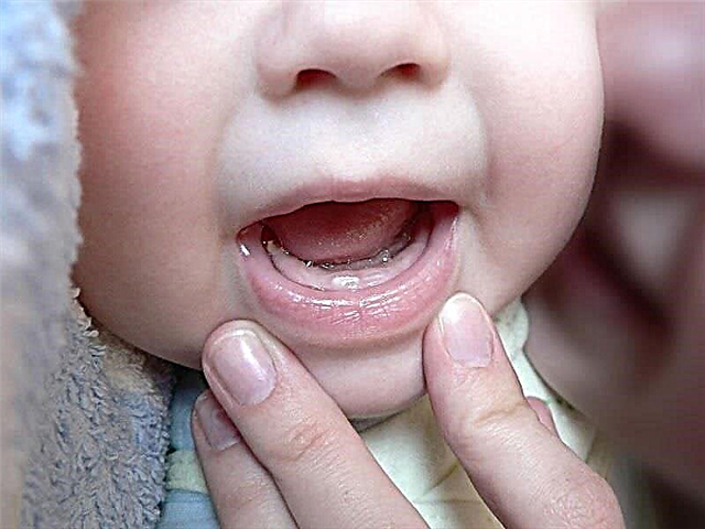 Kan en baby få en rennende nese under tennene?