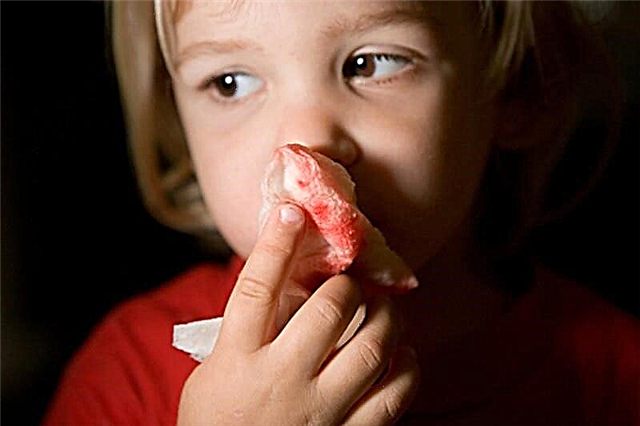 Hvorfor bløder et barn under ett år fra nesen?