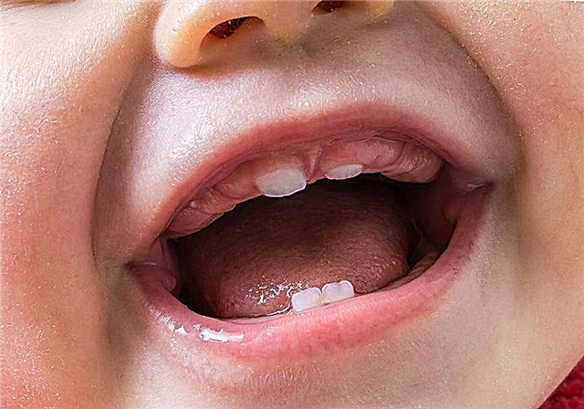 How long does the first teeth erupt in infants?