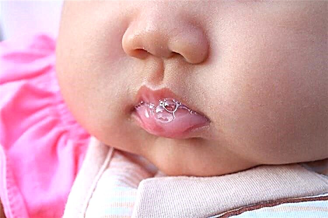 A baby is drooling at 2 months