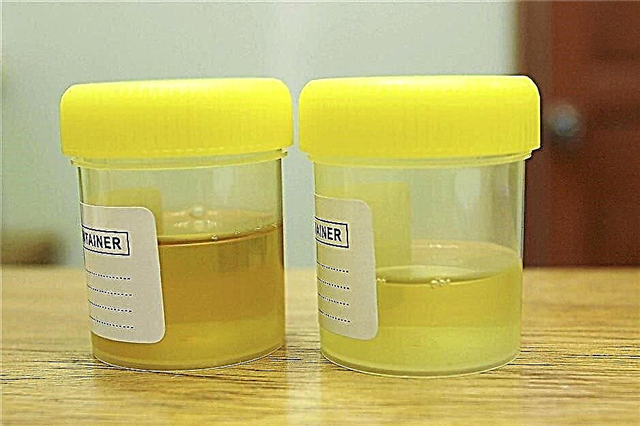 Sarea în urină la un copil sub un an - norma și conținutul crescut