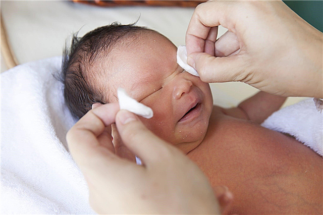 Pijat kanal lacrimal pada bayi baru lahir - cara memijat mata bayi