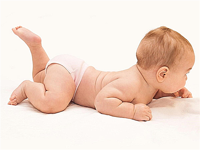 Asymmetrical folds on the legs of the baby