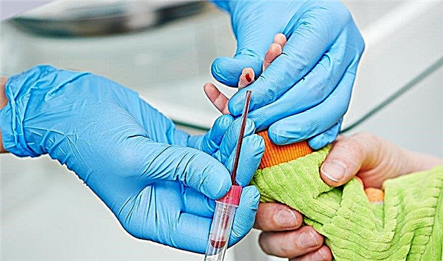 Plazemske celice v krvi otroka glede na rezultate analize