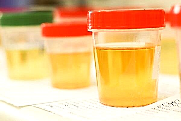 De ce un copil are urină tulbure, un sediment înseamnă o infecție