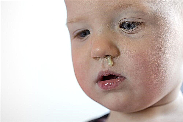 Ranho branco em uma criança com menos de um ano de idade - o que significa muco turvo no nariz