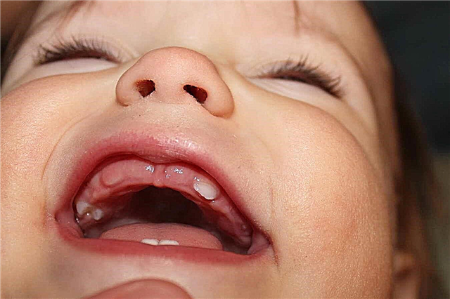 Bir çocukta ilk tırmanan dişler - diyagram