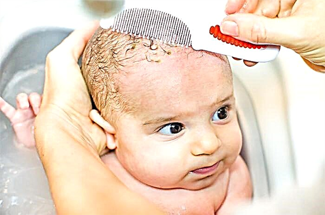 Mengupas kulit di kepala bayi - apa yang harus dilakukan