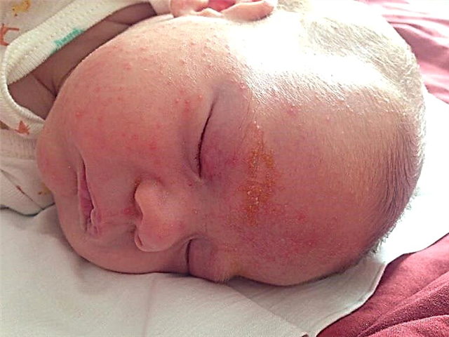 赤ちゃんの眉毛の皮-取り除く方法