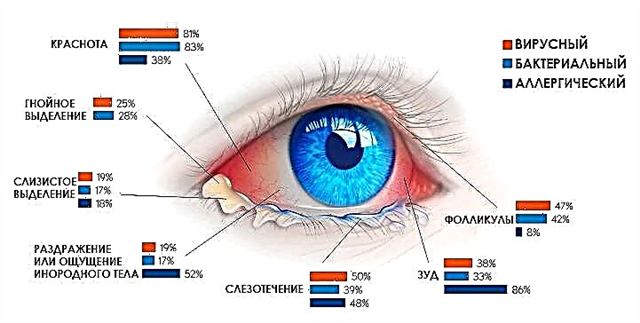 Secreção dos olhos de um recém-nascido - causas de muco
