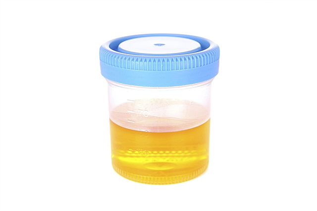 Análise de urina de acordo com Sulkovich em um bebê que mostra como coletar urina