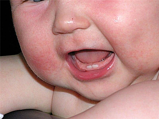 Tekenen van tandjes krijgen bij een baby van 3 maanden
