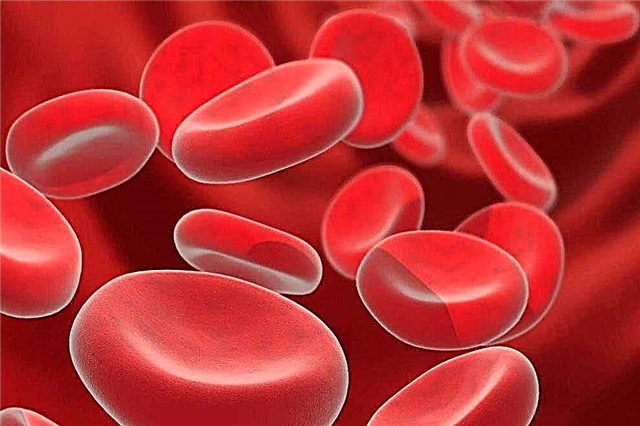 Cara menguraikan ujian darah pada kanak-kanak di bawah satu tahun