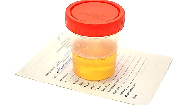 Analisis urin pada anak di bawah satu tahun - decoding dalam tabel nilai normal