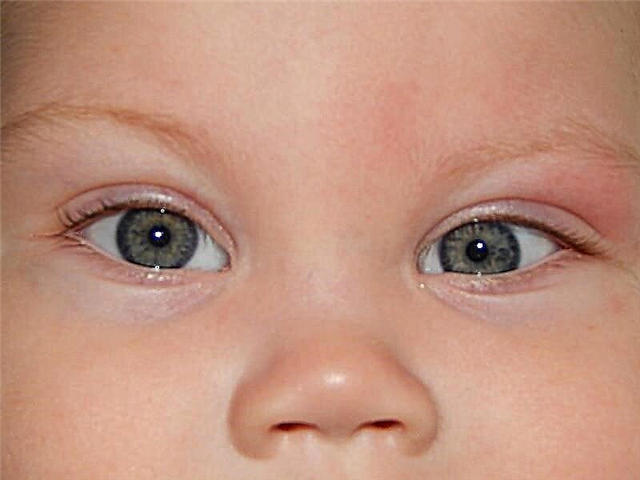 Por que os olhos do recém-nascido correm em direções diferentes?