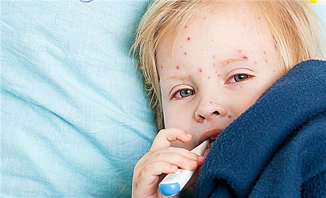 Febre, erupção cutânea e tosse em uma criança - o que é