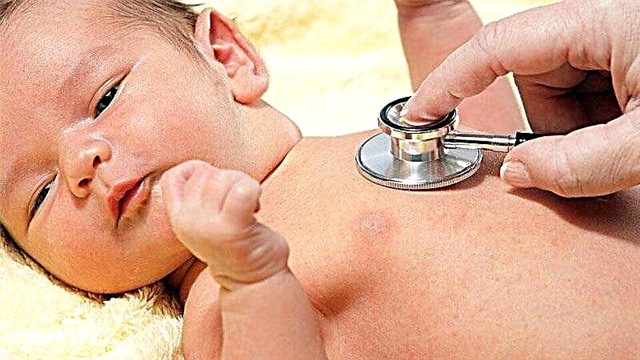 Kaszel ze świszczącym oddechem u dziecka - przyczyny, leczenie