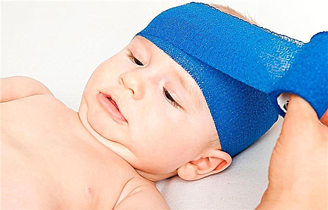 What to do if a newborn baby hits his head