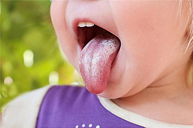 Osip u ustima djeteta - mogući uzroci