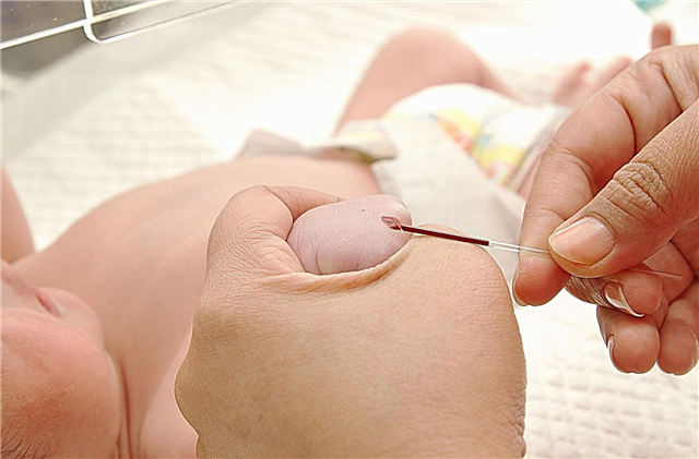 Како узети крв из вене од бебе - припрема, опис процеса
