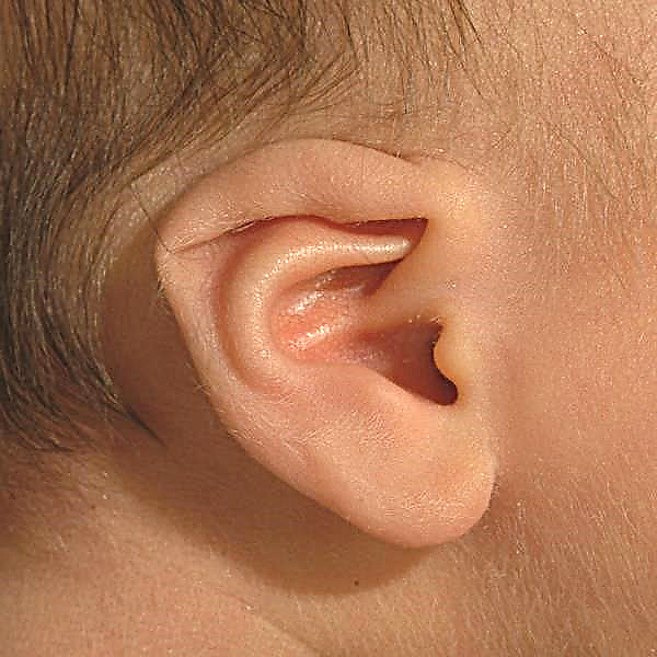 Proč má novorozenec jiné uši - možné příčiny