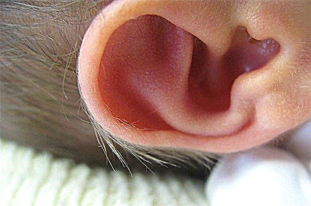 Hogyan lehet eltávolítani az újszülött fülszőrzetét