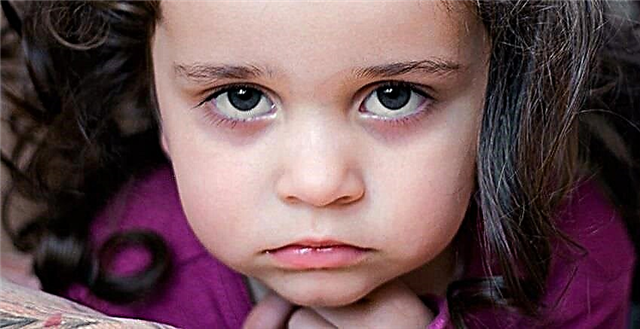 Hematomas sob os olhos de uma criança - o que os leva a eles e o que significam