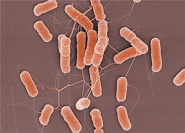 המוליזינג של Escherichia coli אצל תינוקות - תסמינים