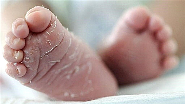 Proč se pokožka novorozence na pažích, nohou, břiše, tváři odlupuje