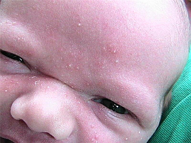 Why do small red, white pimples appear on the body of a child