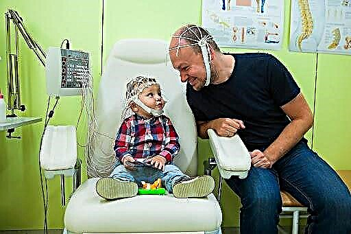 EEG mozku dítěti - co to je, jak se to děje u kojenců