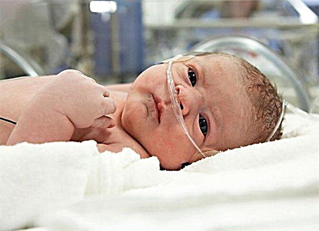 Hipoksia pada bayi baru lahir - apa itu, gejala, konsekuensi, dan pengobatannya