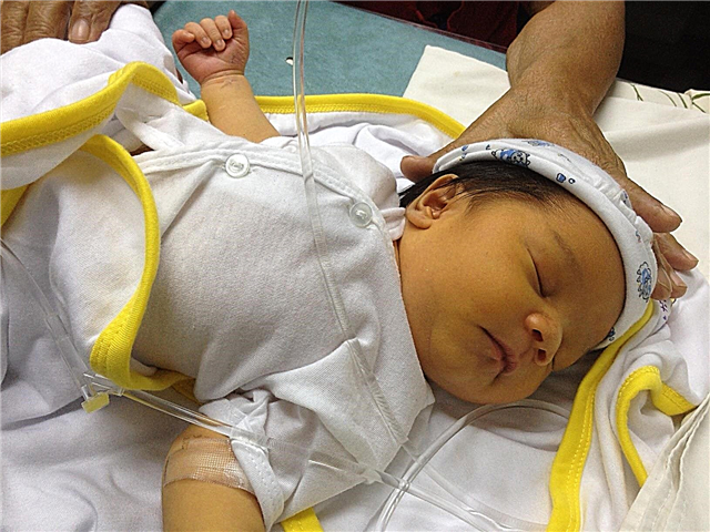 Hvorfor blir babyen gul etter fødselen - mulige årsaker
