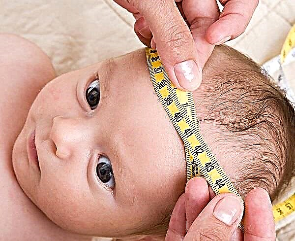 Lebka novorozence: anatomie, příčiny deformity, podmínky vyrovnání