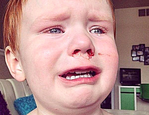 Apa yang harus dilakukan jika hidung anak membentur lantai dengan keras dan berdarah