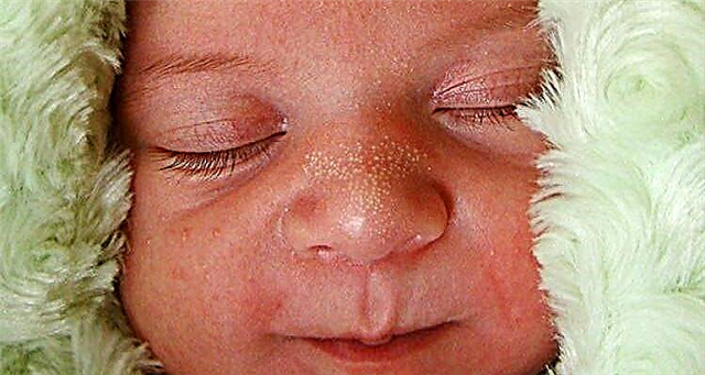 Бели точки на носа на новородено - какво е това