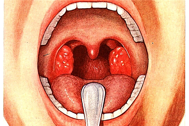 What to do if the tonsils are enlarged in a child under one year old
