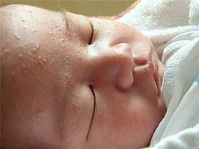 Tuky na tváři novorozence, na nos, na hlavu - co to je