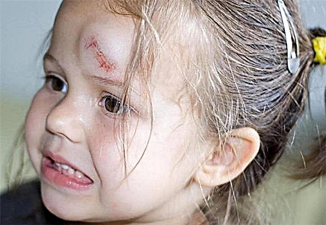 Uma protuberância na testa da criança, o que fazer se a criança bater com força