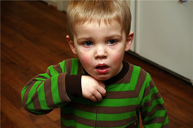 Tør hoste hos et barn: hvordan behandles det?